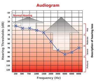 Audioclean Aparelhos Auditivos